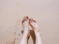 ¿Qué problemas son los más comunes en los pies en verano?